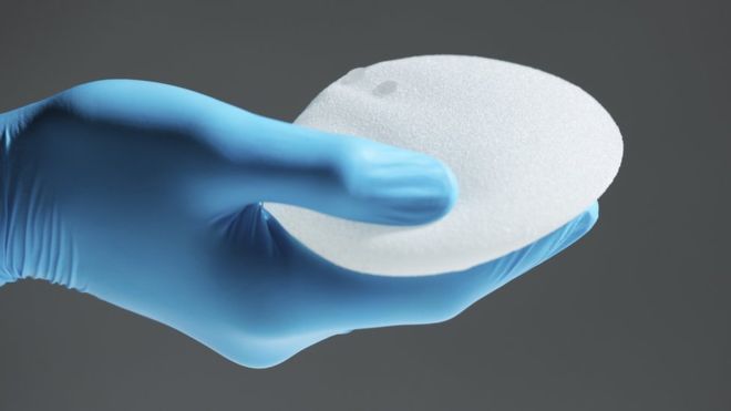 El extraño tipo de cáncer vinculado a los implantes de mama