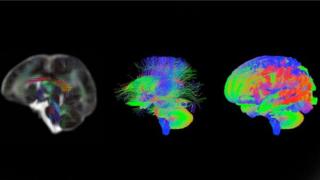 Las imágenes que muestran por primera vez cómo se forman trillones de conexiones en el cerebro de los bebés