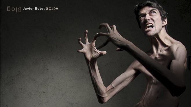 Qué es el síndrome de Marfan y cómo un actor español logró utilizarlo creativamente para cumplir un sueño