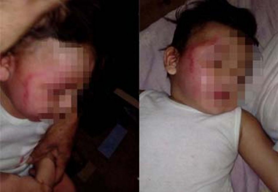 bebe golpeado, Niño golpeado, Nicaragua, Facebook
