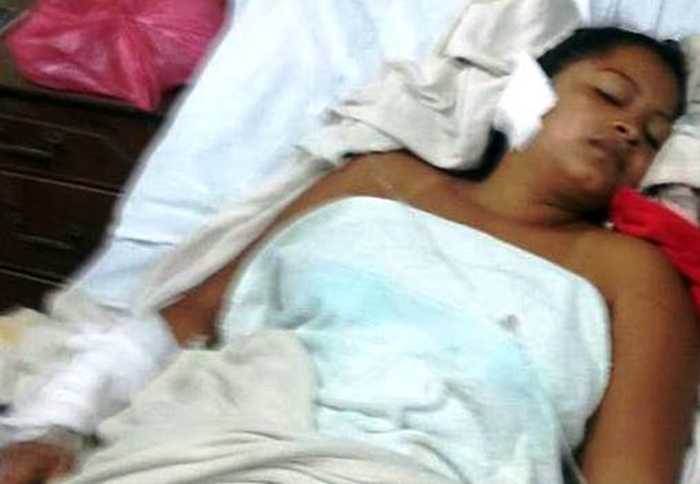 Jamileth Espinoza escapó de la muerte por las heridas de su ex compañero de vida / LA PRENSA / S. Martínez / Cortesía