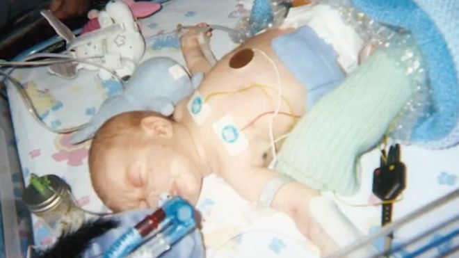 Le daban semanas de vida pero va a cumplir 18 años: Liam Derbyshire, el joven británico que puede morir si se queda dormido espontáneamente