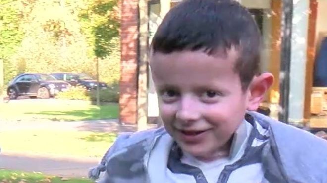 El innovador método por el que consiguieron curar a un niño con epidermólisis bullosa o piel de mariposa