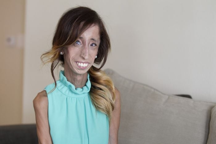 Lizzie Velásquez, bullying