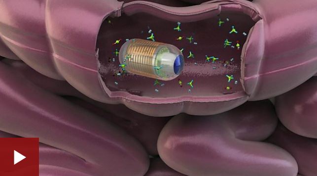 Así funciona la cápsula que mide los gases en tu intestino