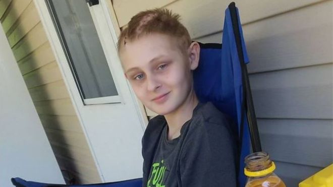 El sorprendente caso de Trenton McKinley, el niño que recuperó la conciencia un día antes de que lo desconectaran en Estados Unidos
