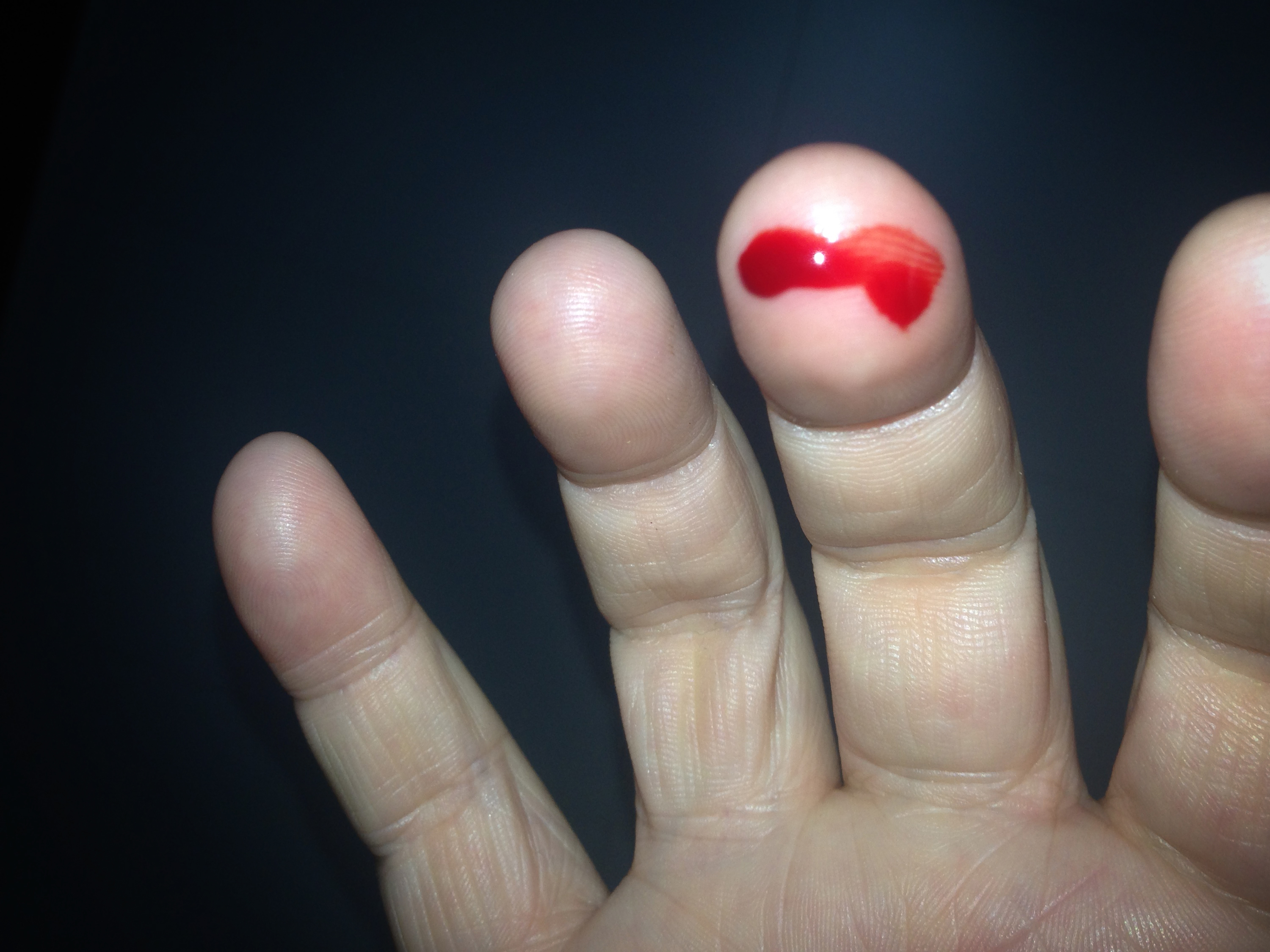 hemofobia