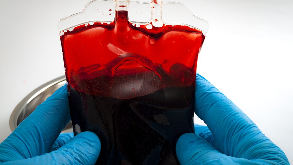 Qué es la inusual «sangre dorada» que puede salvar vidas pero pone en peligro a quien la porta