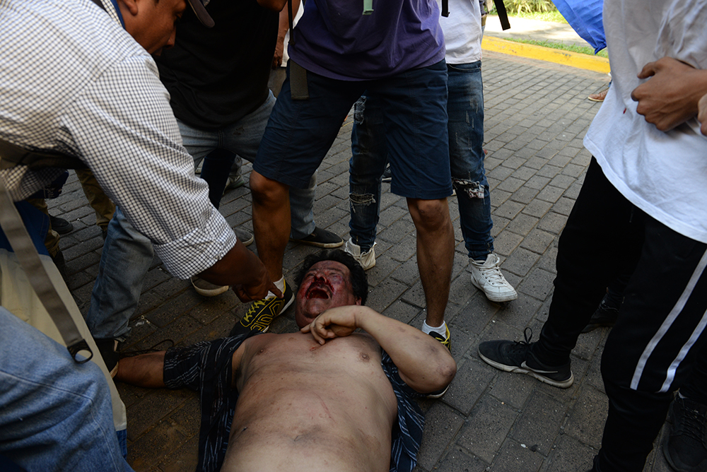 Policía Orteguista miente sobre pistolero que hirió a manifestantes en Metrocentro