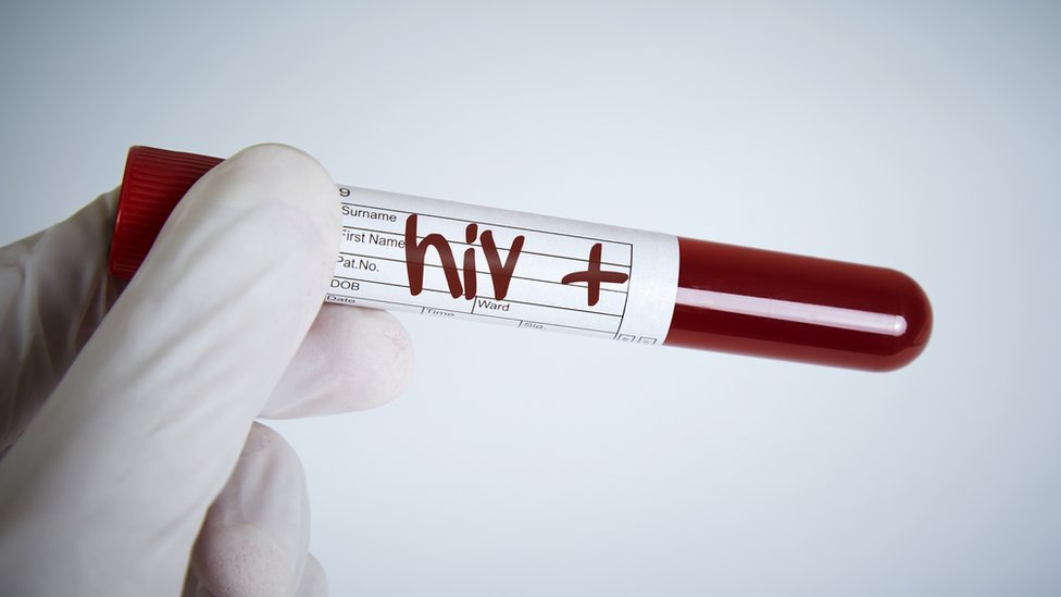 VIH/sida: cuáles son los países de América Latina con mayor aumento de nuevos contagios
