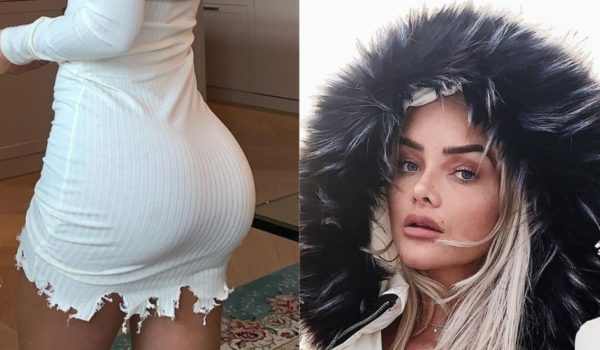 Aumento de glúteos: Sophie Elise, la influencer noruega desesperada por quitarse los implantes que se puso en las nalgas