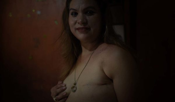cáncer de seno, Nicaragua, mamas, mujeres