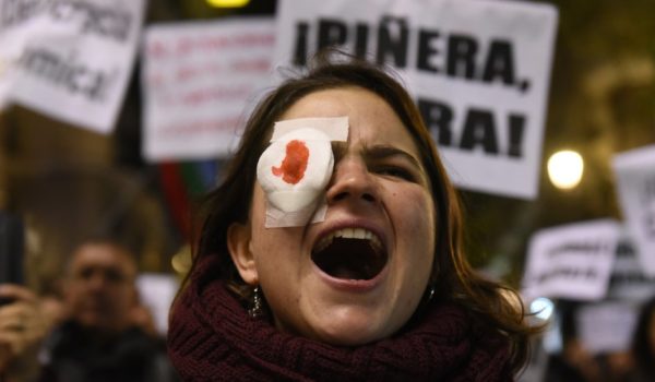 Por qué tantos manifestantes alrededor del mundo están sufriendo lesiones en los ojos