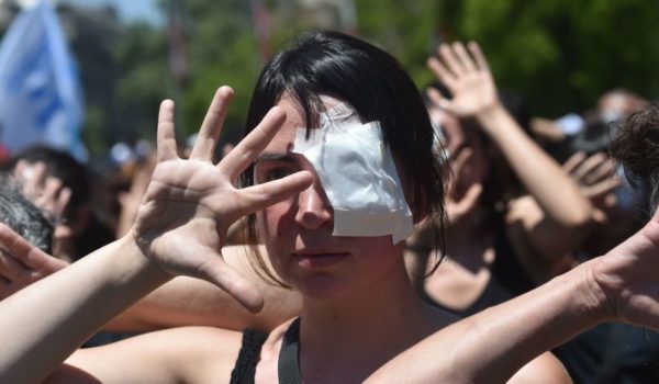 Chile, protestas, perdigones
