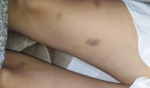 Descartan mano criminal en muerte de la joven Linda Ruiz