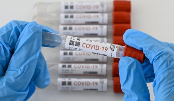 covid-19, médico, pruebas