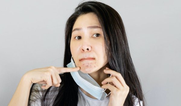 Coronavirus: cómo lidiar con el «maskne», el acné por el uso de la mascarilla