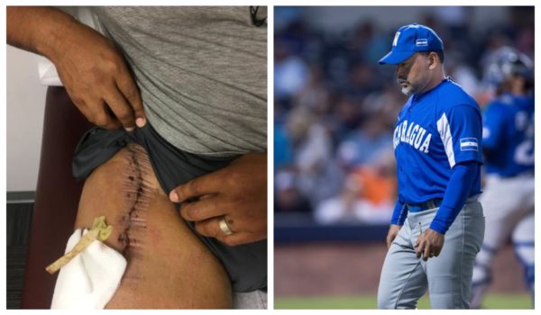 Marvin Benard se rompe el recto femoral y fue enviado al quirófano