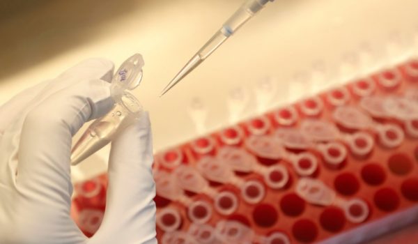 Vacuna contra la covid-19: la inédita carta de 9 farmacéuticas en la que se comprometen a cumplir todas las fases de prueba antes de que salga al mercado