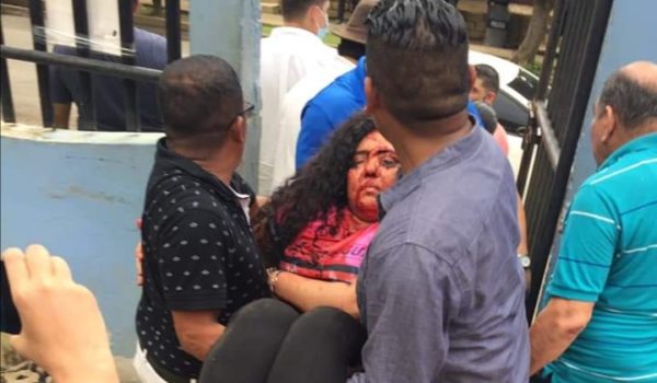 Orteguistas atacan a pedradas reunión opositora en Masaya y hieren a dos periodistas