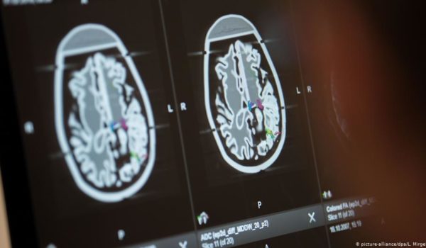 El coronavirus podría entrar en el cerebro a través de la nariz, según estudio
