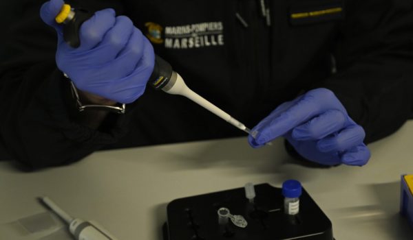 Estas son las diferentes pruebas para detectar coronavirus que existen actualmente