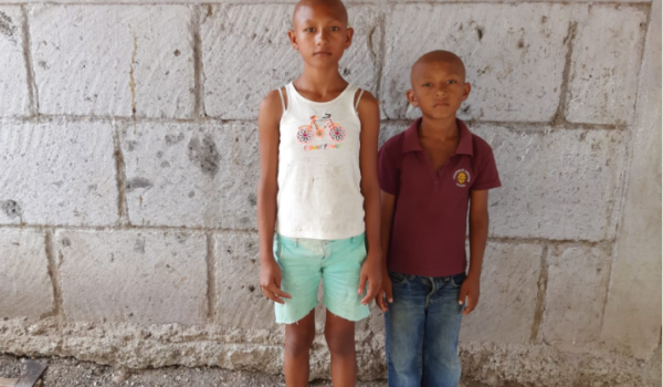 La historia de Francis y Gamaliel, los hermanos a quienes nunca les ha crecido el pelo