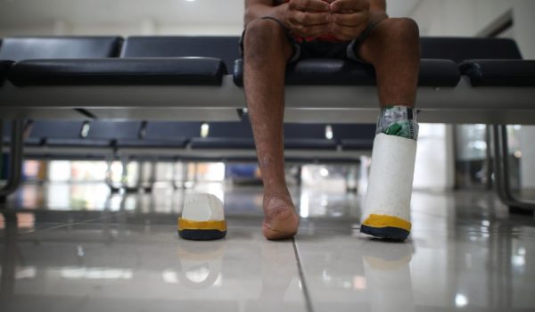La lucha por salir adelante de un joven colombiano al que un cerdo le devoró los pies cuando era bebé