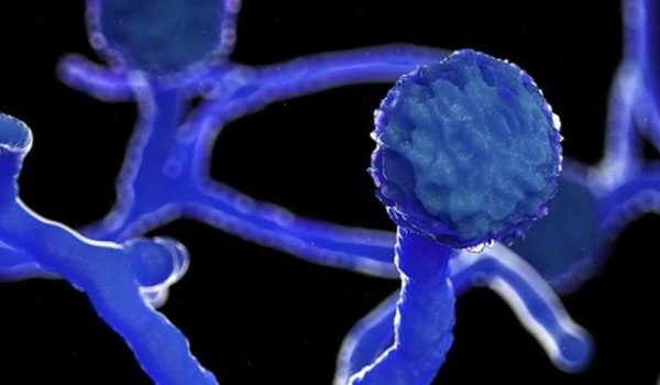 Hongo negro: detectan un caso de mucormicosis en alguien infectado con covid-19 en Uruguay