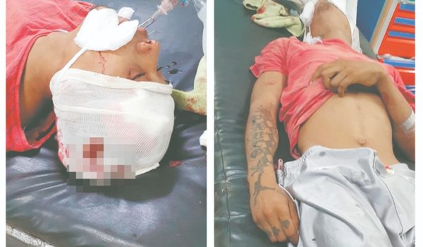 Sorprendió a ladrón en su casa y le disparó a la cabeza