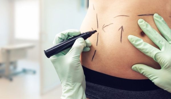 México: cómo la narcoestética está cambiando el cuerpo de las mujeres de Sinaloa