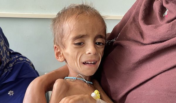 «Una joven rogaba que la mataran a ella y a su bebé»: el hospital en Afganistán donde los niños mueren de desnutrición