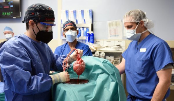 3 cuestiones éticas en torno a los trasplantes de corazón de cerdos en humanos