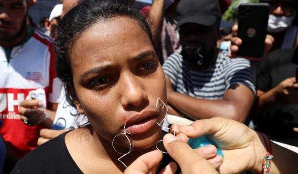 Un grupo de migrantes varados en la frontera sur de México se cose la boca en señal de protesta