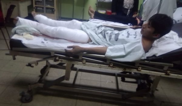 Augusto César López, convalece en el hospital Fernando Vélez Paiz. LA PRENSA/Cortesía