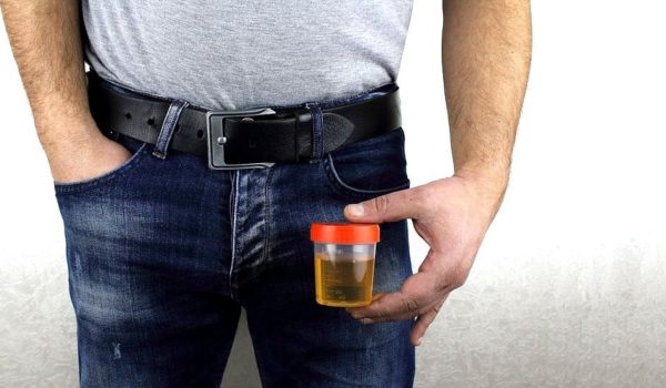 El revolucionario hallazgo que vincula el cáncer de próstata con bacterias en la orina