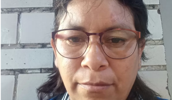 «Si me sacan la bala me muero»: Marisol García Alcántara, la mexicana a la que la Patrulla Fronteriza disparó en la cabeza y ahora va a demandar a EE.UU.