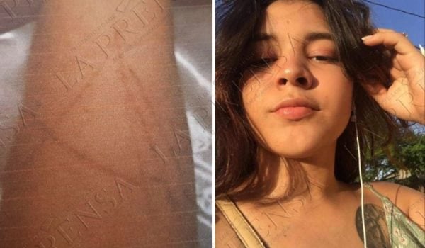En la muñeca de la mano izquierda de Jeyssy Moreira Silva se observa la letra A tatuada con una hambre blanca por el sospechoso Abraham Pineda LA PRENSA