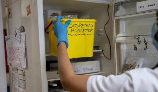 Viruela del mono: detectan el primer caso en Venezuela