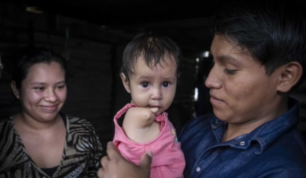 Génesis y Alexa, las niñas que aprendieron a vivir con una rara enfermedad