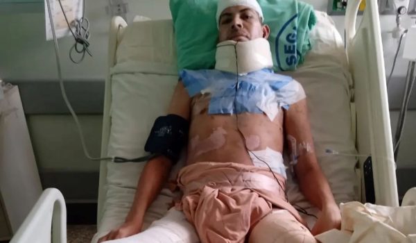“Me estaban quemando”: el estremecedor relato de Anthony