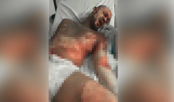 Sujeto le echa gasolina al agresor y lo quema en medio de pleito