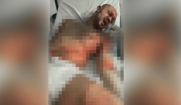 Fallece hombre a quien le prendieron fuego en Corn Island