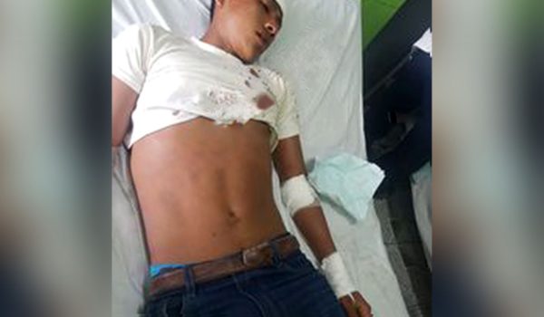 Paseo de estudiantes universitarios de la Costa Caribe termina en accidente