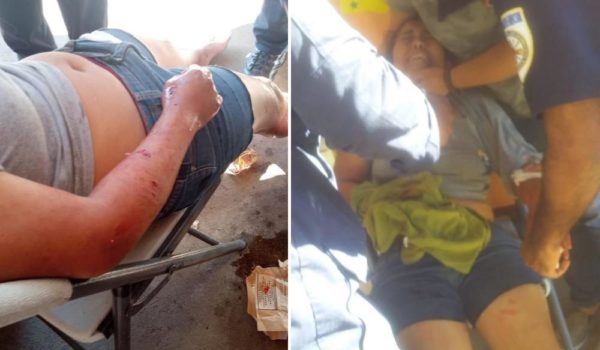 Perro pitbull muerde a joven en San Marcos cuando le daba de comer