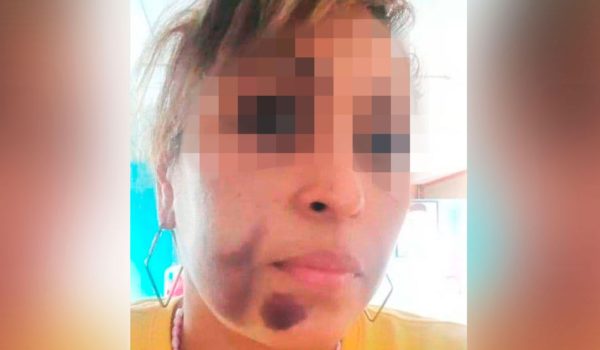 Siete acusados por golpiza a mujer en la isla de Ometepe, incluido un tío de la víctima