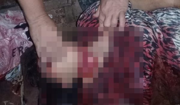 Madre e hija atacadas por delincuentes en zona fronteriza con Costa Rica. Una falleció en el lugar