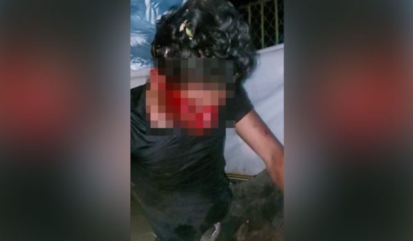 Perros frustran robo y ladrón termina en el hospital