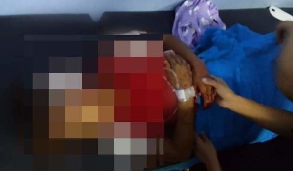 Niña macheteada por sujeto cuando regresaba de la escuela lucha por su vida
