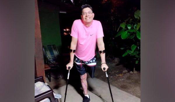 Nicaragüense a quien prendieron fuego reconoce a verdugos en fotografías mostradas por el OIJ de Costa Rica